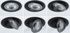 PAULMANN LED vestavné svítidlo White Select Aumus 3ks sada kruhové 105mm 90° 3x5W 230V stmívatelné 2700 - 6500K černá